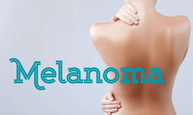 01 Melanoma